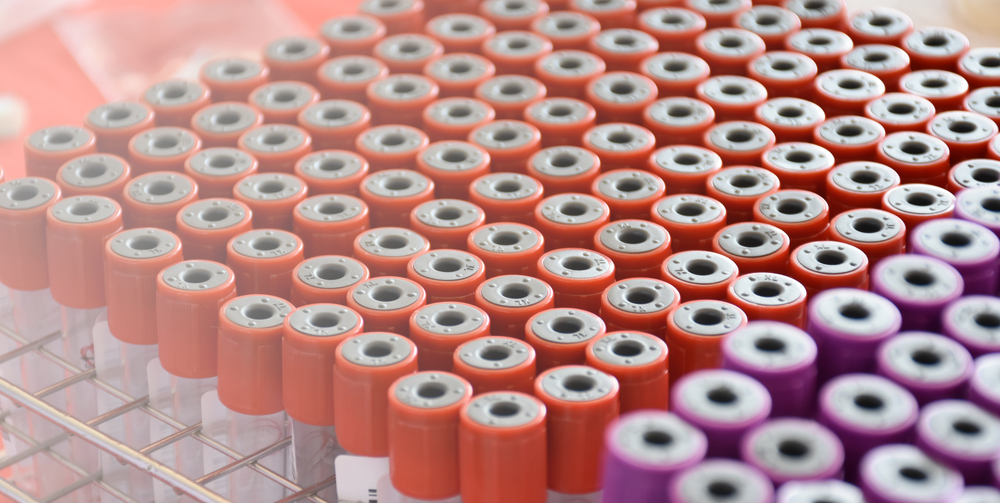 vials of blood samples